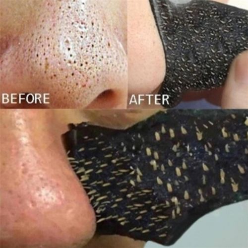 Nose Blackhead Remover Strips –